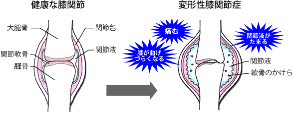 〈図『きょうの健康』より〉